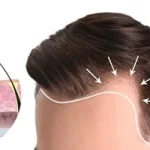 مدل طراحی هیرلاین بر اساس بانک مو؛ چگونه به نتیجه‌ای طبیعی برسیم؟